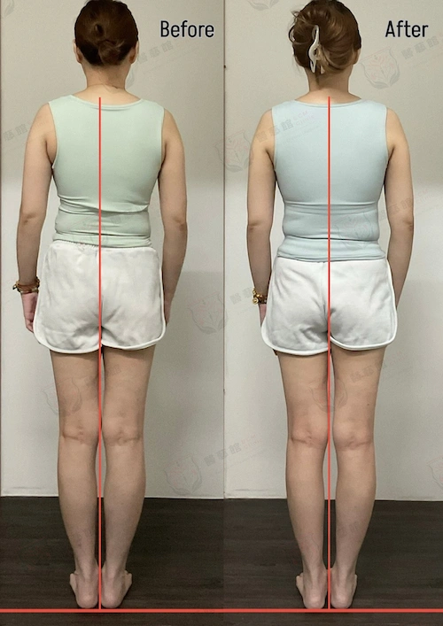 CASE 05 真實案例 Before/After