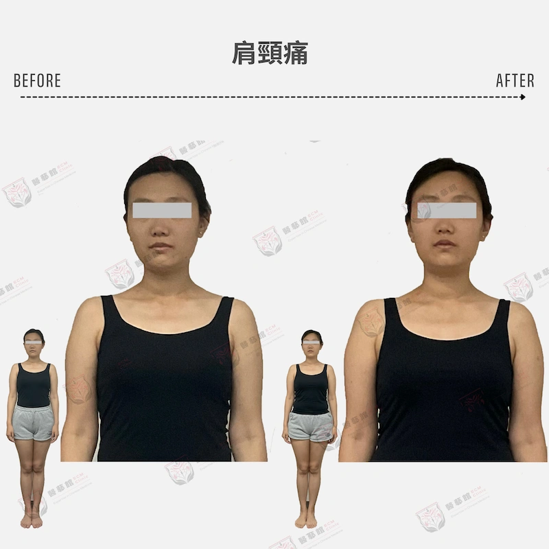 經前不適・少腹痛・頭痛