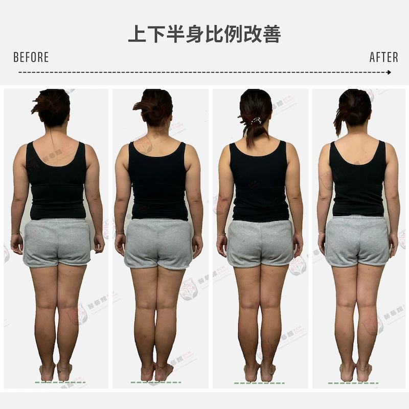 上下半身比例改善 體態改善