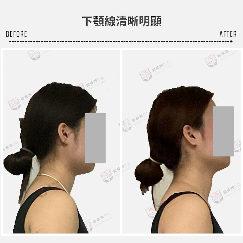 下顎線清晰