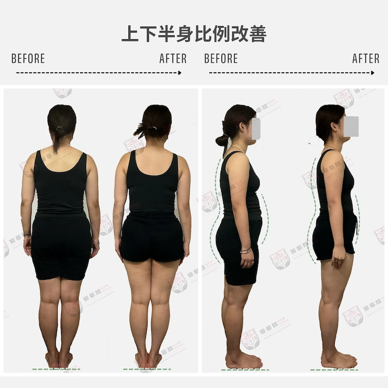 啤梨身型-上下比例改善