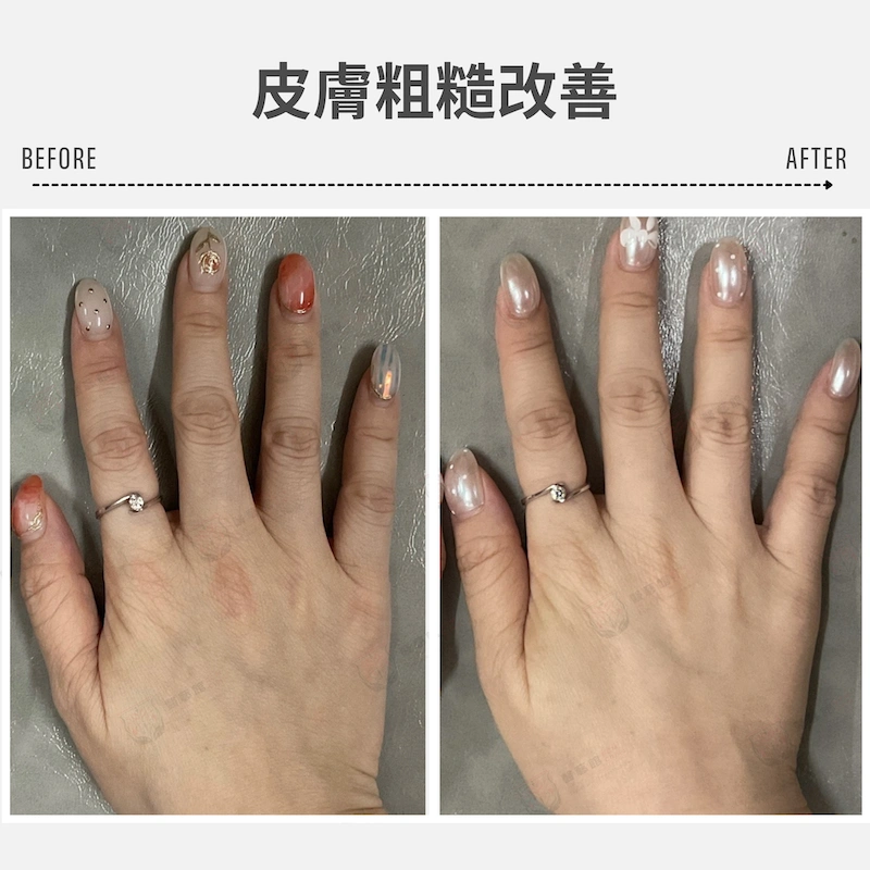 皮膚粗糙改善