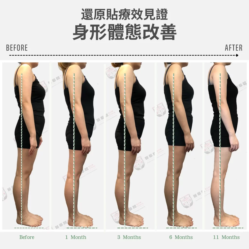 身形體態改善