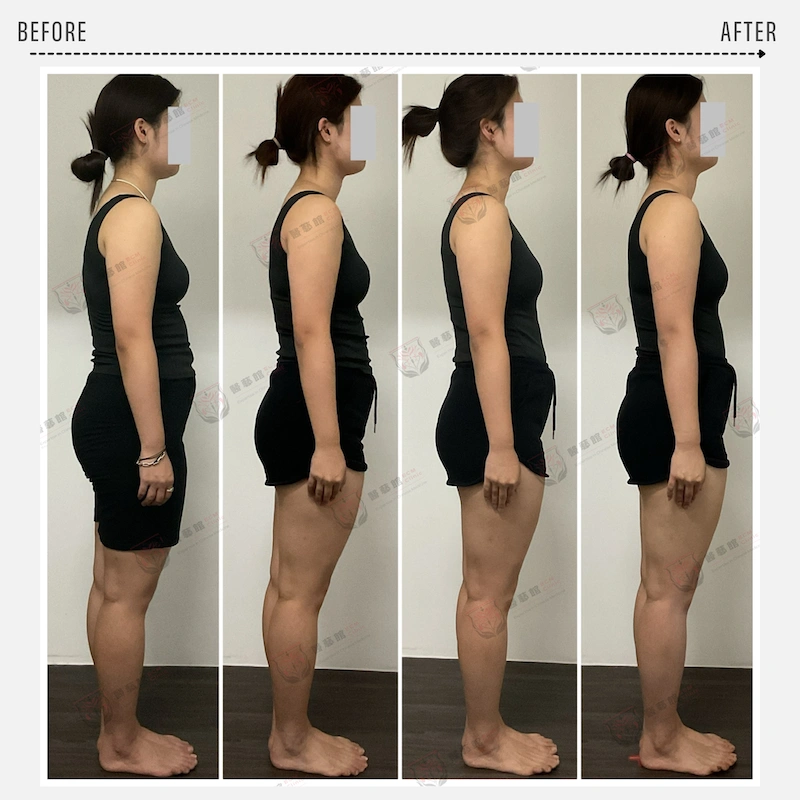 CASE 03 真實案例 Before/After